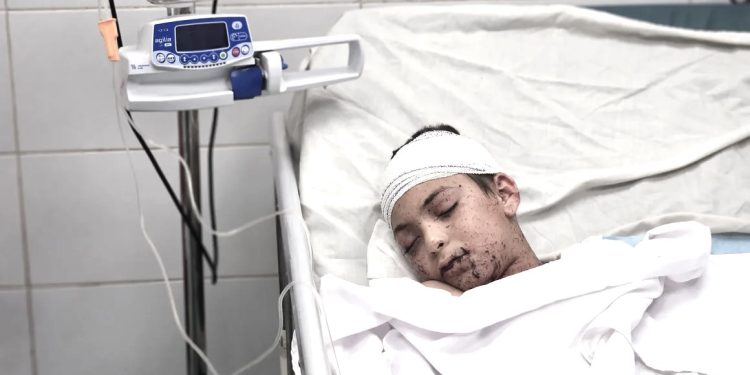 “Nga bombardimet, krahas shumë të vdekurve, mjekes palestineze Alaa al-Najjar, në rripin jugor të Gazës, nga dhjetë fëmijë që kishte, ju vranë nëntë, pasi…”/ Refleksionet e shkrimtarit të njohur